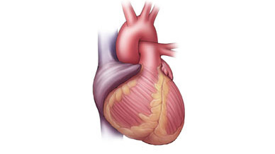 Heart Arrhythmia